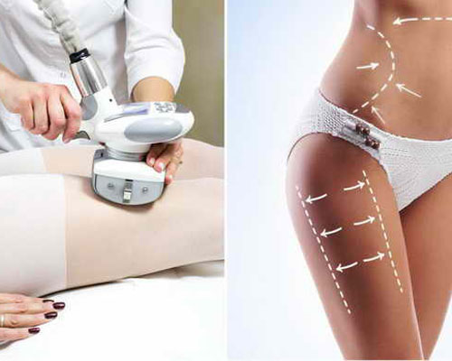 Lymphatic drainage massage by LPG