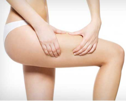 Cellulite Reduction (35 Mins)